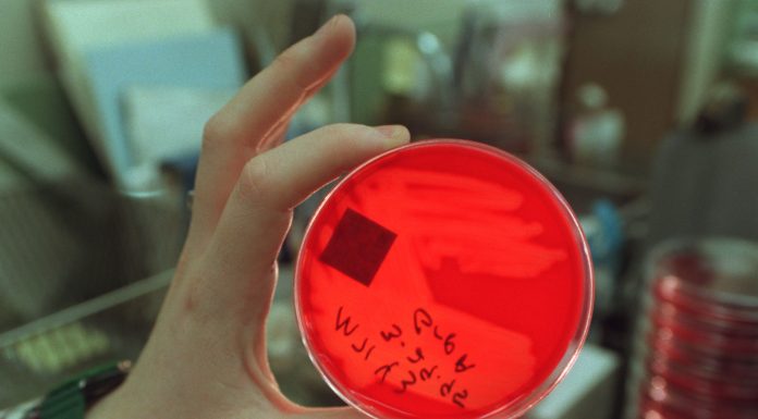 A dangerous form of Strep A is on the rise in children amid a growing shortage of common medication a-dangerous-form-of-strep-a-is-on-the-rise-in-children-amid-a-growing-shortage-of-common-medication