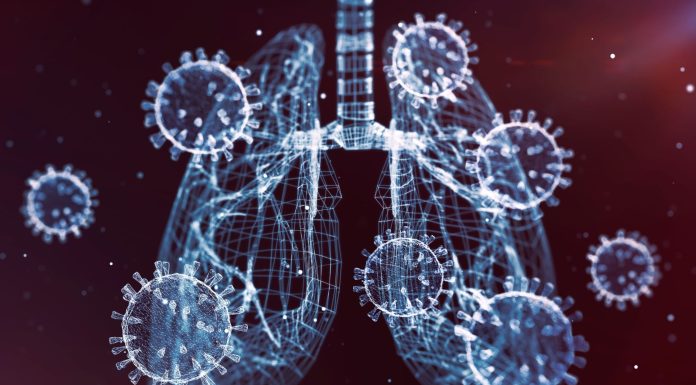 Pneumonia is the No. 1 cause of hospital admission in kids and adults. Watch for these signs and symptoms pneumonia-is-the-no-1-cause-of-hospital-admission-in-kids-and-adults.-watch-for-these-signs-and-symptoms